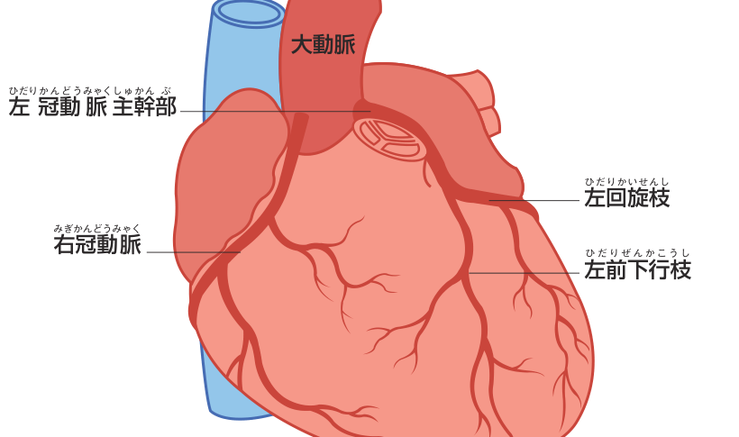 心臓の外壁に沿って伸びる冠動脈を示した図。大動脈から左冠動脈主幹部が分かれ、左前下行枝と左回旋枝に、反対側に右冠動脈が伸びている