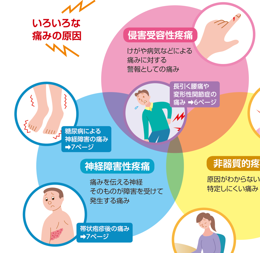 侵害受容性疼痛、神経障害性疼痛、非器質的疼痛の3つの痛みの原因と、それぞれに当てはまる病気の例を示した図
