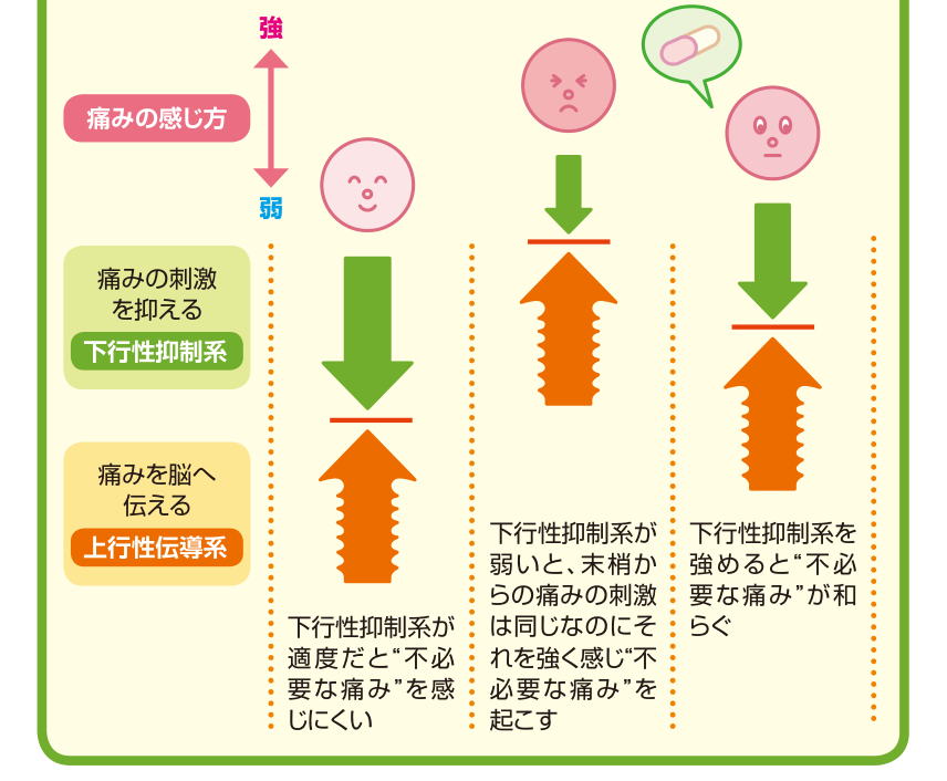 痛みを脳へ伝える上行性伝導系と、痛みの刺激を抑える下行性抑制系の強さのバランスによって、不必要な痛みの感じ方が変わることを示した図