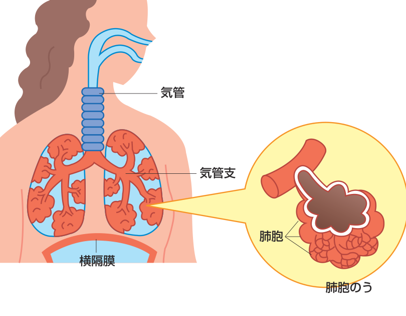 気管・気管支から枝分かれして肺胞・肺胞のうへつながる呼吸器の仕組みと、気管支の位置にある横隔膜を示した図