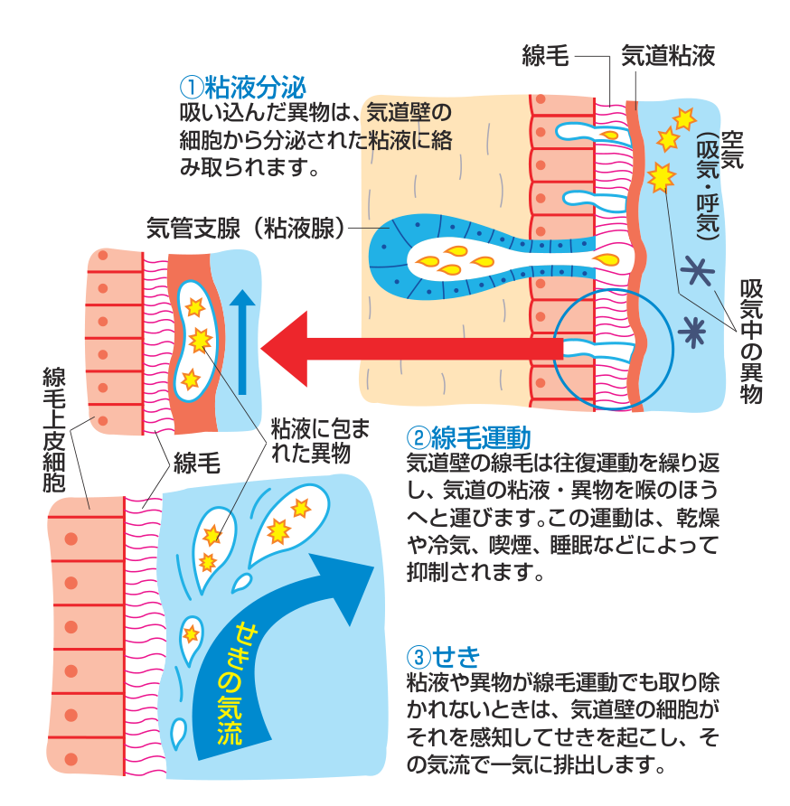 気道壁の粘液が異物を絡め取り、線毛運動で喉のほうへ運び、それでも取り除けないときにせきが起きるまでの流れを示した図