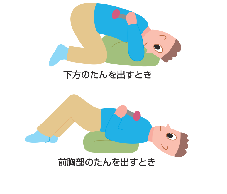 下方のたんを出すときと前胸部のたんを出すとき、それぞれの体位ドレナージの姿勢を示した図