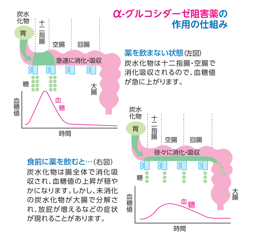 薬を飲まないと炭水化物が十二指腸・空腸で急速に消化吸収されて血糖値が急に上がるのに対し、食前に薬を飲むと腸全体でゆっくり消化吸収され血糖値の上昇が穏やかになることを示した図