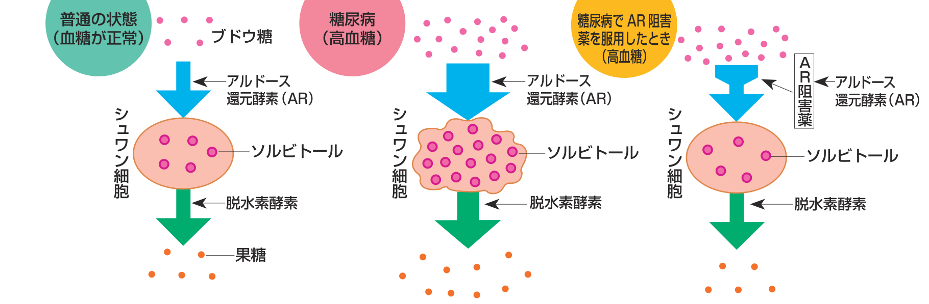 シュワン細胞の中でブドウ糖がアルドース還元酵素によりソルビトールになり、脱水素酵素で果糖になる流れを、普通の状態（血糖が正常）・糖尿病（高血糖）・糖尿病でAR阻害薬を服用したときの三つで比べた図