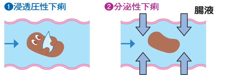 浸透圧性下痢では便が水分を抱えたまま、分泌性下痢では腸液が腸の内側へ流れ込むようすを示した図