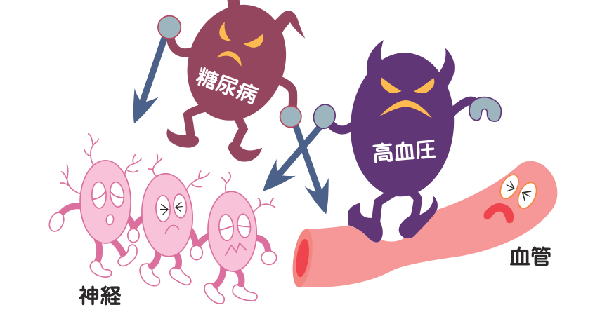 糖尿病と高血圧が神経と血管を傷めつけ、EDのリスクを高めるしくみを示した図