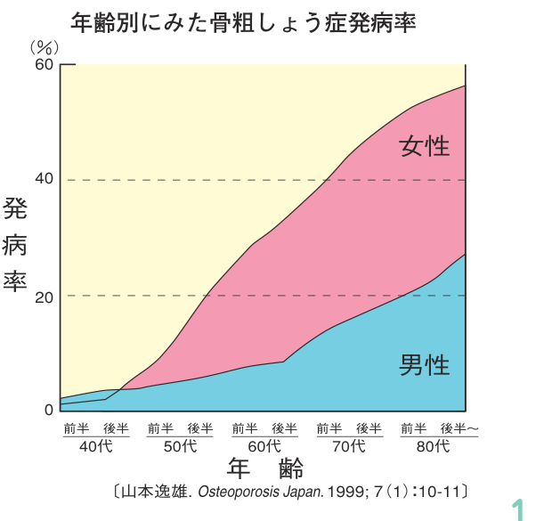 年代別の骨粗しょう症発病率を示すグラフ。40代から80代にかけて男女とも発病率が上昇し、とくに女性で急増することを表している