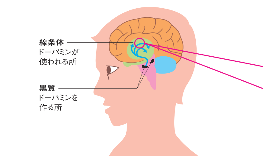 脳の中で、黒質でドーパミンが作られ、線条体でドーパミンが使われるようすを示した図