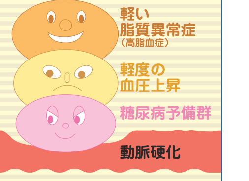 軽い脂質異常症（高脂血症）、軽度の血圧上昇、糖尿病予備群という軽い異常が重なり合って、動脈硬化を起こすようすを示した図